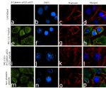 Phospho-beta Catenin (Ser33, Ser37) Antibody