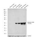 Calbindin D28K Antibody in Western Blot (WB)