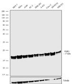 NME1 Antibody in Western Blot (WB)