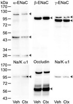 SCNN1G Antibody in Western Blot (WB)