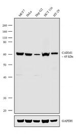 PRMT4 Antibody in Western Blot (WB)