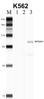 HRI Antibody in RNA Immunoprecipitation (RIP)