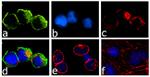 JAK3 Antibody in Immunocytochemistry (ICC/IF)