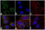 Phospho-PKA alpha/beta (Thr197) Antibody in Immunocytochemistry (ICC/IF)