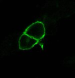 mGluR2 Antibody in Immunocytochemistry (ICC/IF)