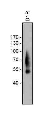 DRD1 Antibody in Western Blot (WB)