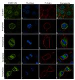 CK1 alpha Antibody in Immunocytochemistry (ICC/IF)