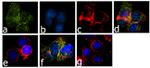 Phospho-Btk (Tyr223) Antibody in Immunocytochemistry (ICC/IF)