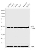 NSE Antibody in Western Blot (WB)