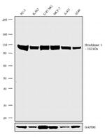 HK1 Antibody in Western Blot (WB)