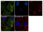 LDHA Antibody in Immunocytochemistry (ICC/IF)