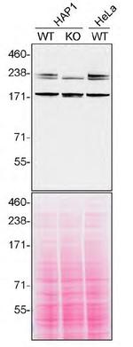 SPG11 Antibody in Western Blot (WB)