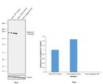 SPG11 Antibody in Western Blot (WB)