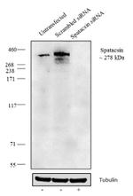 SPG11 Antibody in Western Blot (WB)