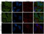 SOD1 Antibody in Immunocytochemistry (ICC/IF)