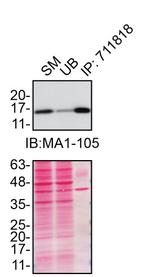 SOD1 Antibody in Immunoprecipitation (IP)