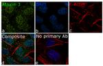 Ataxin 3 Antibody in Immunocytochemistry (ICC/IF)