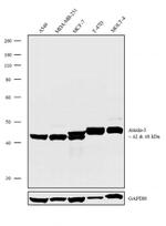 Ataxin 3 Antibody in Western Blot (WB)