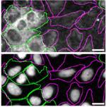 Optineurin Antibody