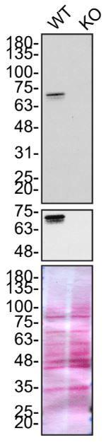 Optineurin Antibody in Western Blot (WB)