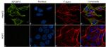 IGF2BP3 Antibody in Immunocytochemistry (ICC/IF)