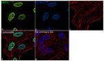 MBD1 Antibody in Immunocytochemistry (ICC/IF)