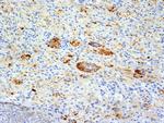 TNF-alpha (Tumor Necrosis Factor alpha) Antibody in Immunohistochemistry (Paraffin) (IHC (P))