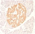 TNF-alpha (TumorNecrosis Factor alpha) Antibody in Immunohistochemistry (Paraffin) (IHC (P))