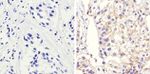 beta Catenin Antibody in Immunohistochemistry (Paraffin) (IHC (P))