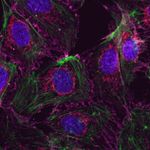 beta Catenin Antibody in Immunocytochemistry (ICC/IF)