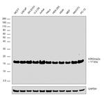 H3R2me2a Antibody in Western Blot (WB)