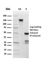 Topoisomerase II alpha (Proliferation and Drug-Resistance Marker) Antibody in SDS-PAGE (SDS-PAGE)