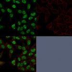 Topoisomerase II alpha Antibody in Immunocytochemistry (ICC/IF)