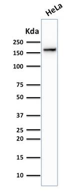 Topoisomerase II alpha Antibody in Western Blot (WB)