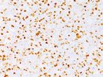 Topoisomerase II alpha Antibody in Immunohistochemistry (Paraffin) (IHC (P))