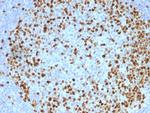 Topoisomerase II alpha Antibody in Immunohistochemistry (Paraffin) (IHC (P))