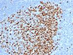 Topoisomerase II alpha Antibody in Immunohistochemistry (Paraffin) (IHC (P))