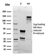 Topoisomerase II alpha Antibody in SDS-PAGE (SDS-PAGE)