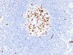 Topoisomerase II alpha (Proliferation and Drug-Resistance Marker) Antibody in Immunohistochemistry (Paraffin) (IHC (P))