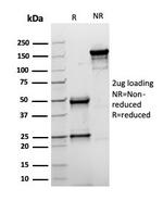 Topoisomerase II alpha (Proliferation and Drug-Resistance Marker) Antibody in SDS-PAGE (SDS-PAGE)