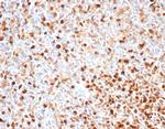 Topoisomerase II alpha (Proliferation and Drug-Resistance Marker) Antibody in Immunohistochemistry (Paraffin) (IHC (P))