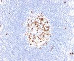 Topoisomerase II alpha (Proliferation and Drug-Resistance Marker) Antibody in Immunohistochemistry (Paraffin) (IHC (P))