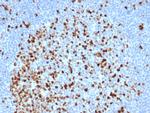 Topoisomerase II alpha Antibody in Immunohistochemistry (Paraffin) (IHC (P))