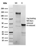 Topoisomerase II alpha Antibody in SDS-PAGE (SDS-PAGE)