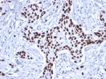 p53 Tumor Suppressor Protein Antibody in Immunohistochemistry (Paraffin) (IHC (P))