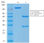 p53 Tumor Suppressor Protein Antibody in SDS-PAGE (SDS-PAGE)