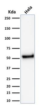 p53 Tumor Suppressor Protein Antibody in Western Blot (WB)