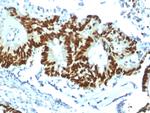 p53 Tumor Suppressor Protein Antibody in Immunohistochemistry (Paraffin) (IHC (P))