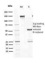 p53 Tumor Suppressor Protein Antibody in SDS-PAGE (SDS-PAGE)