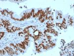 p53 Tumor Suppressor Protein Antibody in Immunohistochemistry (Paraffin) (IHC (P))